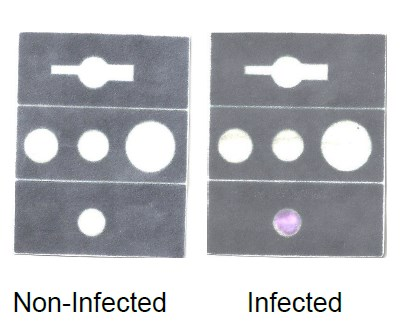 Foldable paper-based devide for detection of infection in body fluids